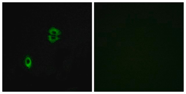 Anti-CCR7 antibody produced in rabbit affinity isolated antibody