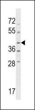 ANTI-NPRL2(C-TERMINAL) antibody produced in rabbit affinity isolated antibody, buffered aqueous solution