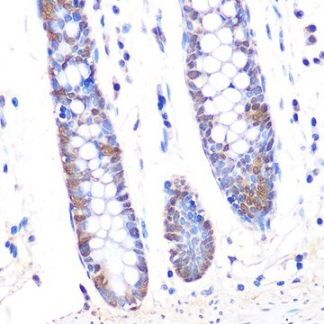 Anti-Thioredoxin 1 (Trx1/TXN) antibody produced in rabbit