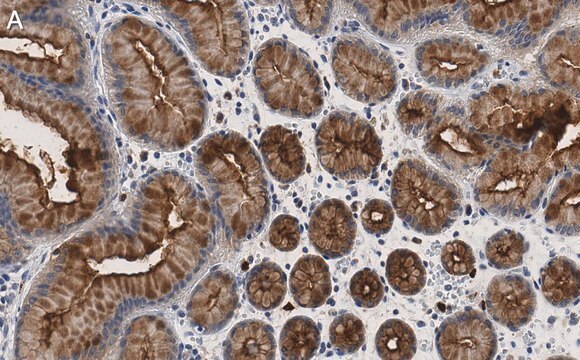 Anti-MUC1 Antibody, clone 1F23 ZooMAb&#174; Rabbit Monoclonal recombinant, expressed in HEK 293 cells