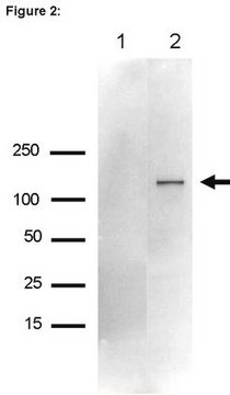 RIPAb+ Upf1 - RIP Validated Antibody and Primer Set from rabbit