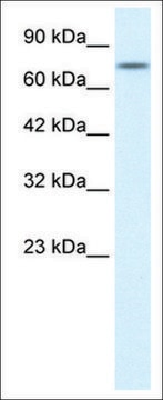 Anti-RIPK1 antibody produced in rabbit affinity isolated antibody