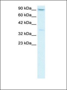 Anti-TBP from hog kidney IgG fraction of antiserum