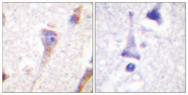 Anti-PKD1 antibody produced in rabbit affinity isolated antibody