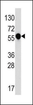 ANTI-IL1R (C-TERM E487) antibody produced in rabbit IgG fraction of antiserum, buffered aqueous solution