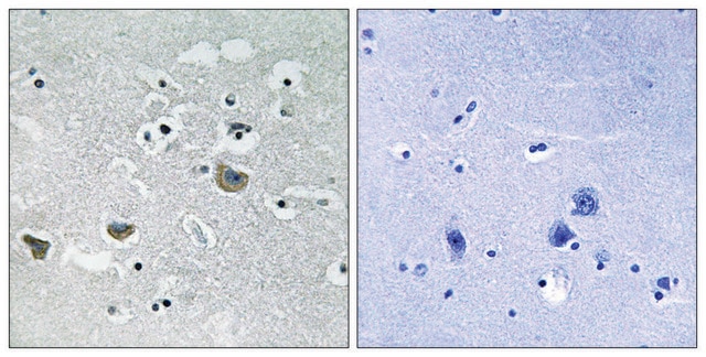 Anti-SREBP-1 antibody produced in rabbit affinity isolated antibody