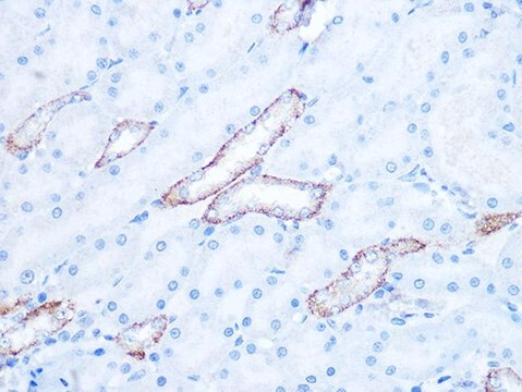 Anti-IRAK2 antibody produced in rabbit