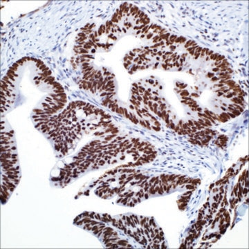 SATB2 (EP281) Rabbit Monoclonal Primary Antibody