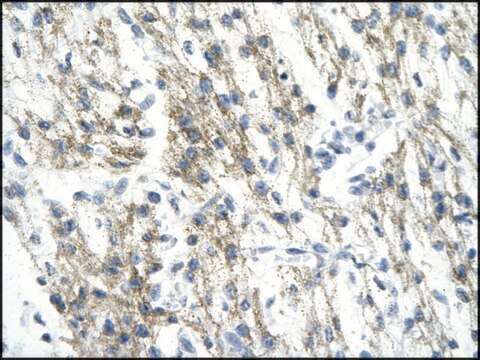 Anti-RUVBL1 antibody produced in rabbit affinity isolated antibody