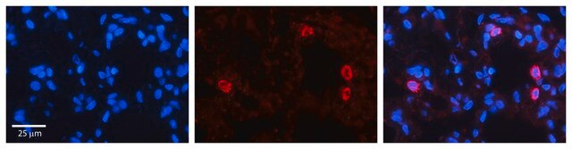 Anti-NFATC4 (AB2) antibody produced in rabbit affinity isolated antibody