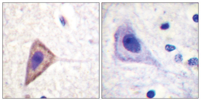 Anti-KV1.3 antibody produced in rabbit affinity isolated antibody