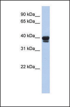 Anti-NAPE-PLD, (N-terminal) antibody produced in rabbit affinity isolated antibody