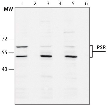 Anti-Phosphatidylserine Receptor antibody produced in rabbit 1-1.5&#160;mg/mL, affinity isolated antibody, buffered aqueous solution