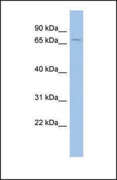 Anti-ACCN2 affinity isolated antibody