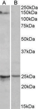 Anti-RBM20 antibody produced in goat affinity isolated antibody, buffered aqueous solution