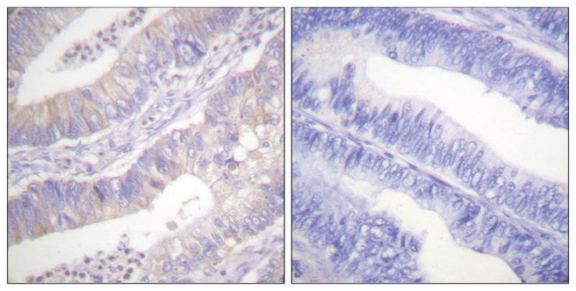 Anti-CFTR antibody produced in rabbit affinity isolated antibody