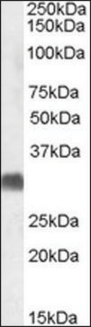 Anti-SRD5A2 (C-terminal) antibody produced in goat affinity isolated antibody, buffered aqueous solution