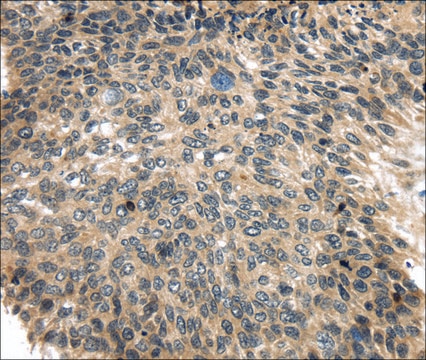 Anti-USP9X affinity isolated antibody