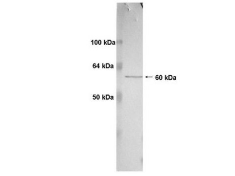 Anti-Human MT1-MMP catalytic domain Antibody, clone 3G4.2 clone 3G4.2, Chemicon&#174;, from mouse