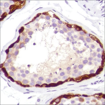 Anti-MAGE-A1 antibody, Rabbit monoclonal clone SP194, recombinant, expressed in proprietary host, affinity isolated antibody