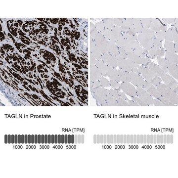 Anti-TAGLN antibody produced in rabbit affinity isolated antibody, buffered aqueous glycerol solution