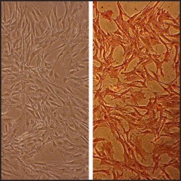 Bovine Aortic Smooth Muscle Cells: BAOSMC (Cryovial)