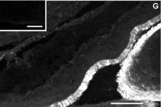 Monoclonal Anti-Cytokeratin Peptide 14 antibody produced in mouse clone CKB1, ascites fluid