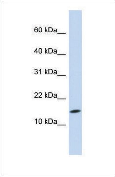 Anti-UBE2D3 antibody produced in rabbit affinity isolated antibody