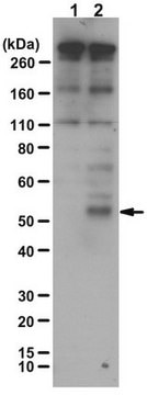 Anti-Stra8 Antibody from rabbit, purified by affinity chromatography