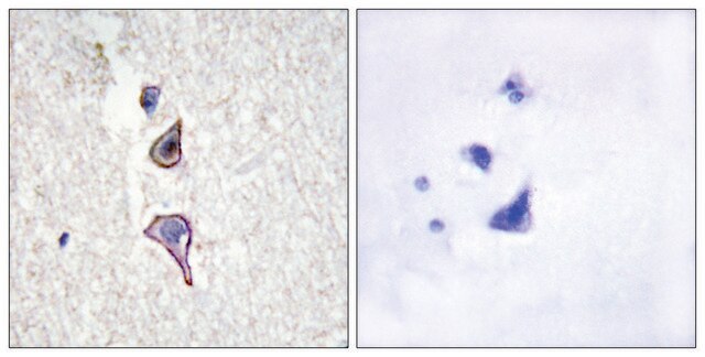 Anti-MRC2 antibody produced in rabbit affinity isolated antibody