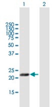 Anti-MFAP5 antibody produced in mouse purified immunoglobulin, buffered aqueous solution