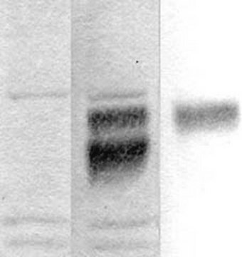 Anti-Amyloid Precursor Protein Antibody, KPI Domain serum, Chemicon&#174;