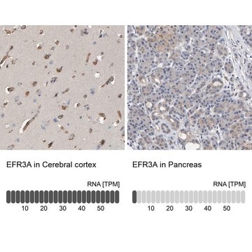 Anti-EFR3A antibody produced in rabbit Prestige Antibodies&#174; Powered by Atlas Antibodies, affinity isolated antibody, buffered aqueous glycerol solution, Ab3