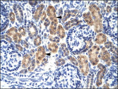 Anti-MyCBP antibody produced in rabbit affinity isolated antibody