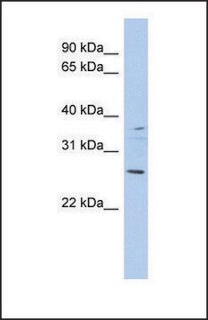 Anti-ASCL2 antibody produced in rabbit affinity isolated antibody