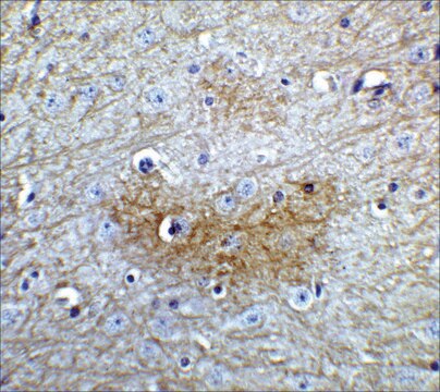 Anti-GLS2 antibody produced in rabbit affinity isolated antibody