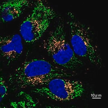 BioTracker 560 Orange Lysosome Dye Live cell imaging dye for acidic cellular organelles such as lysosomes.