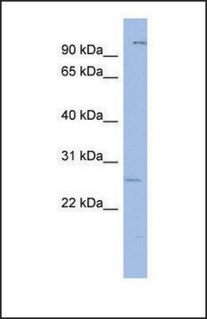 Anti-GSX1, (N-terminal) antibody produced in rabbit affinity isolated antibody