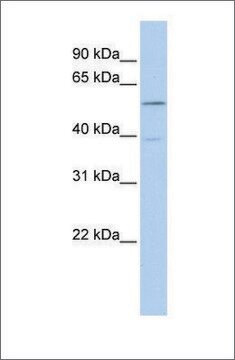 Anti-ESR2 antibody produced in rabbit affinity isolated antibody