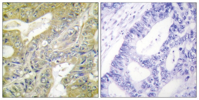 Anti-HEXB antibody produced in rabbit affinity isolated antibody