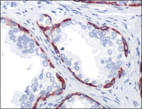 Anti-Keratin 14 antibody, Rabbit monoclonal recombinant, expressed in proprietary host, clone SP53, affinity isolated antibody