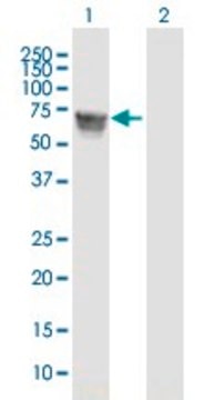 Anti-GBA antibody produced in mouse purified immunoglobulin, buffered aqueous solution