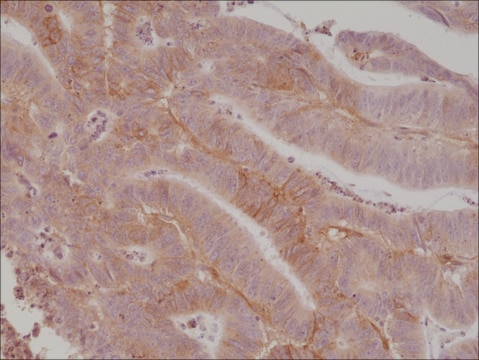 Anti-CD276 (B7-H3) antibody, Rabbit monoclonal recombinant, expressed in HEK 293 cells, clone RM335, purified immunoglobulin