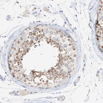 Anti-SLC25A31 antibody produced in rabbit Prestige Antibodies&#174; Powered by Atlas Antibodies, affinity isolated antibody, buffered aqueous glycerol solution