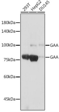 Anti-GAA Antibody, clone 5L2L10, Rabbit Monoclonal