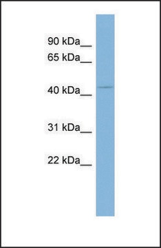 Anti-UGCG antibody produced in rabbit affinity isolated antibody