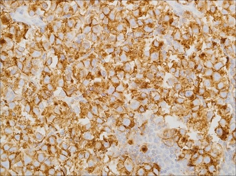 PLAP (EP194) Rabbit Monoclonal Primary Antibody