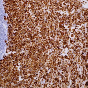 Nestin (10C2) Mouse Monoclonal Antibody