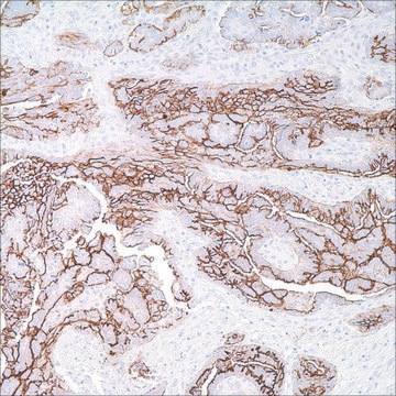 CA-125 (OC125) Mouse Monoclonal Antibody