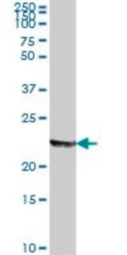 Anti-MFAP2 antibody produced in mouse purified immunoglobulin, buffered aqueous solution